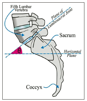 Derékfájás okai - L5 csigolya