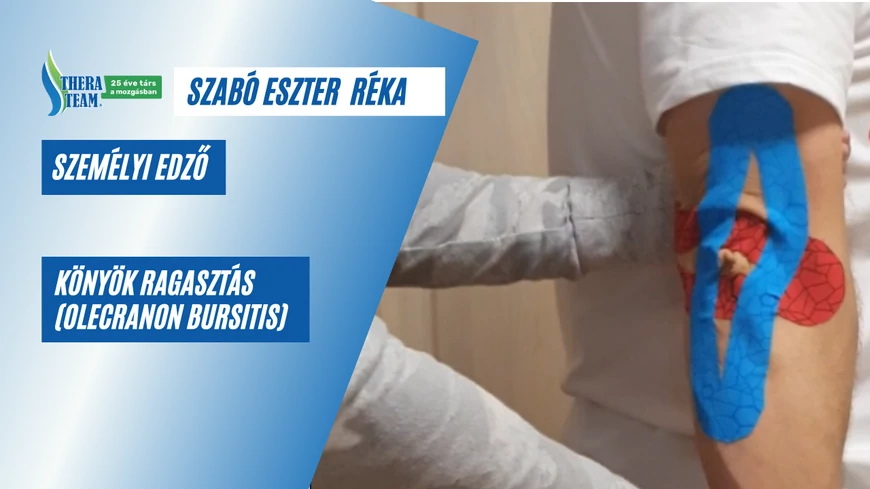 Kinesio tape technikák - Könyök ragasztás (Olecranon Bursitis) - videóval